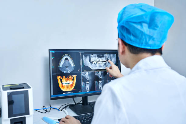 Best Emergency Care for Gum Disease in Santa Clara, CA